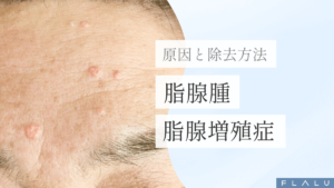 浜松町皮膚科_MV_顔イボの原因と除去_251227