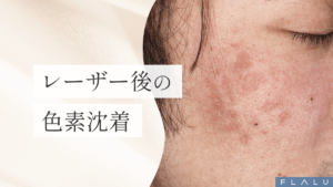 浜松町皮膚科_MV_色素沈着_251228
