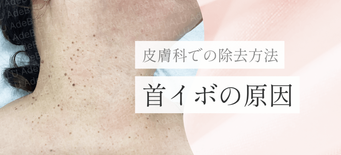 浜松町皮膚科_MV_首イボの原因_251227