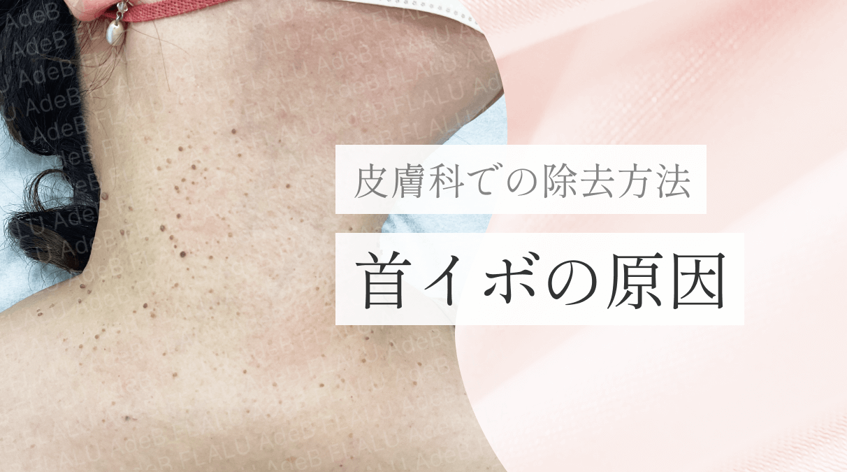 浜松町皮膚科_MV_首イボの原因_251227