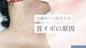 浜松町皮膚科_MV_首イボの原因_251227