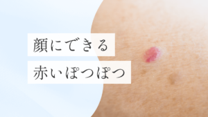 浜松町皮膚科_MV_赤いぽつぽつ_251228