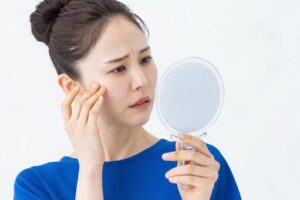 脂腺腫ができやすい人の傾向