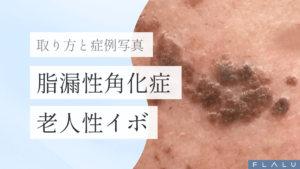 浜松町皮膚科_MV_軟性繊維腫_251228